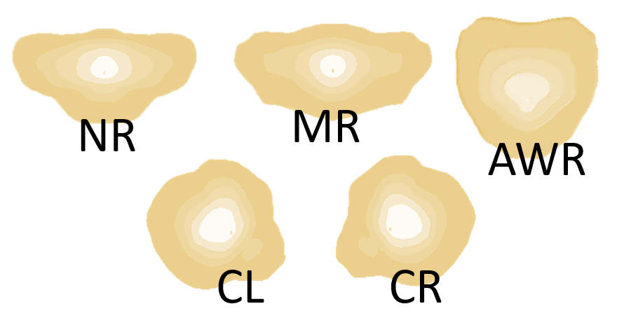 Elektra light distributions